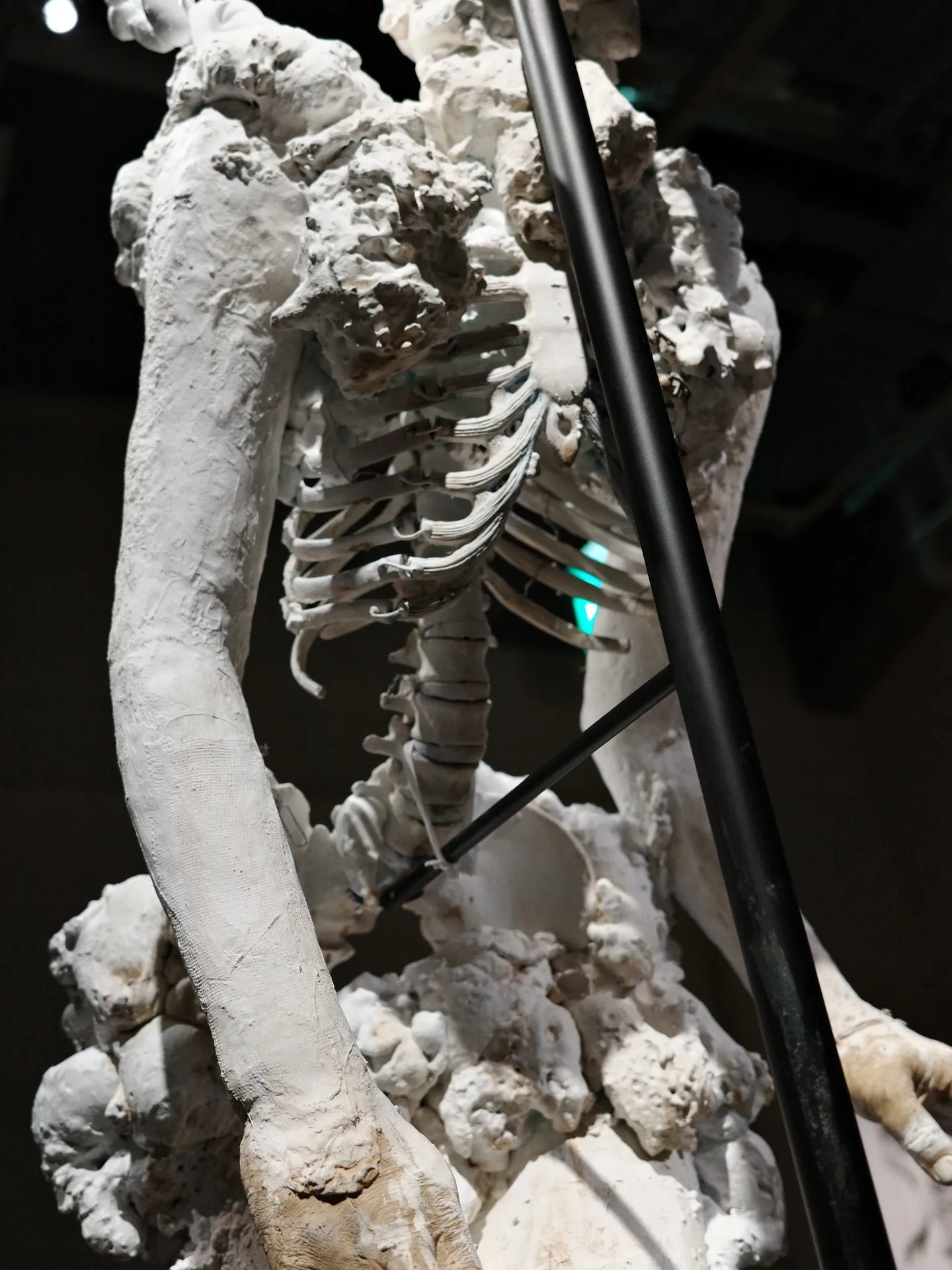 きみはうつくしい　諏訪敦　WHAT MUSEUM